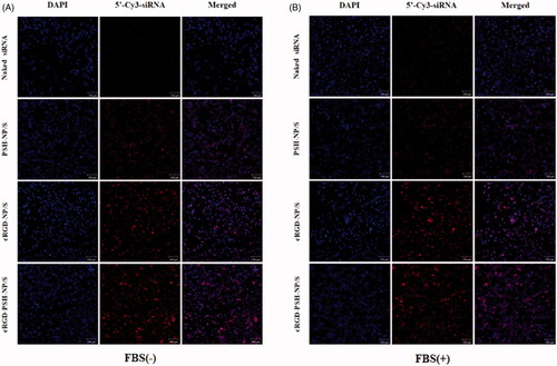 Figure 5. Intracellular distribution of the nanoparticles by confocal laser microscopy. (A) Intracellular localization of 5′-Cy3-labled siRNA delivered by PSH-NP, cRGD-NP and cRGD-PSH-NP without FBS in HepG2 cells (10×). (B) Intracellular localization of 5′-Cy3-labled siRNA delivered by PSH-NP, cRGD-NP and cRGD-PSH-NP with FBS in HepG2 cells (10×). 5′-Cy3-labled siRNA is shown in red, DAPI nuclear stain is shown in blue. Scale bar = 100 μm.