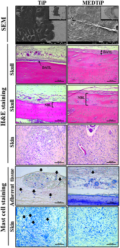 Figure 9. Histopathological structure of MEDTiP-implanted tissues. Adhesive changes were detected in sputter-coated MEDTiP at 100× (right corner) and 1,000× magnifications and in H&E-stained MEDTiP-implanted sections at 400× magnification. Infiltration of mast cells was identified in slide sections of skin and adherent tissue stained with toluidine blue, followed by observation at 400× magnification. Arrows indicate infiltrated mast cells in tissue adjacent to the MEDTiP implant. Three to four rats per group were used in the preparation of tissue slides, mast cell observing was performed in duplicate for each sample. Abbreviations: TiP, Titanium plate; MEDTiP, MED-coated titanium plate; DATL, Densely adhered tissue layer; NBL, New bone layer.