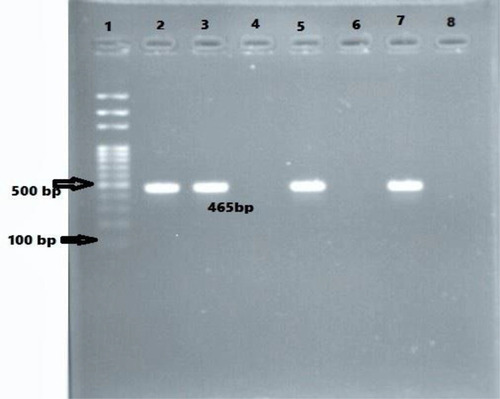 Figure 3 Agarose gel electrophoresis (1.5%) used for separation of PCR products. Lane 2, positive control; Lane 3, 5, and 7 are CITM positive; Lane 4 and 6, CITM negative; and Lane 8. negative control.