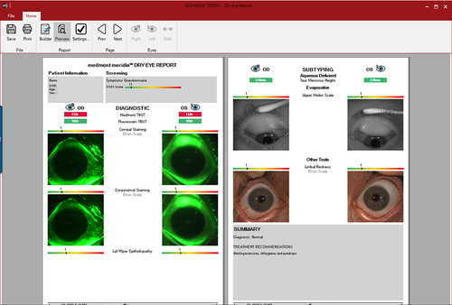 Figure 16 A customized dry eye report presenting the findings in a clear graphic manner.
