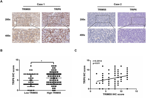 Figure 6 Expression of TRIM55 and TRIP6 were positively correlated in human HCC tissues. (A) Representative IHC staining figures of TRIM55 and TRIP6 expression in serial sections of HCC tumor samples (Scale bar: 50 μm, 20 μm; 20 X, 40 X objective). (B) Distribution of TRIP6 expression level in high TRIM55 expression level group and low TRIM55 expression level group tissues. (C) Pearson correlation analysis between TRIM55 and TRIP6 expression, N = 110. (*P < 0.05).