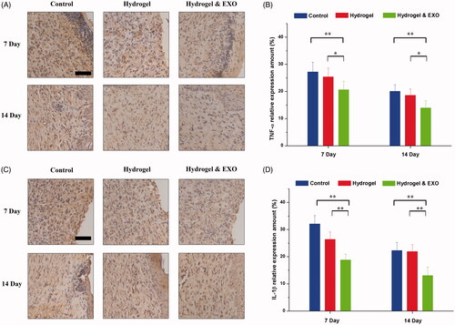 Figure 8. Histochemical analysis of TNF-α and IL-1β expression in wound sites. (A, C) Immunohistochemistry staining images for TNF-α and IL-1β at 7 and 14 days post operation, respectively. Scale bar: 50 μm. (B, D) Quantitative analysis of relative density of TNF-α and IL-1β at 7 and 14 days after surgery, respectively.