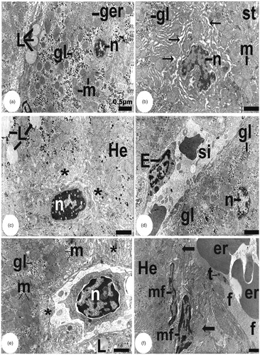 Figure 3. Representative liver section electron microscopy photographs (a–f). Samples from LF rats. L, lipid droplet; m, mitochondria; ger, rough endoplasmic reticulum; gl, glycogen deposits; st, cytoplasm; He, hepatocyte; E, endothelial cell; si, sinusoid; arrow: dilated smooth endoplasmic reticulum; er, erythrocyte; mf, myofibroblast; f, fibrin deposition, t, thrombocyte; black arrow, perisinusoidal localization of connective tissue fibers; asterisk: expanded space of Disse; n, nucleus. Scale = 0.5 µm.