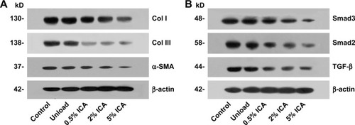 Figure 11 Western blot assay for col I/III, α-SMA (A) and TGF-β, Smad2/3 (B) expression in adhesion tissues with different membrane groups for 4 weeks.Abbreviations: Col I, collagen I; Col III, collagen III; ICA, icariin; kD, k Daleon.