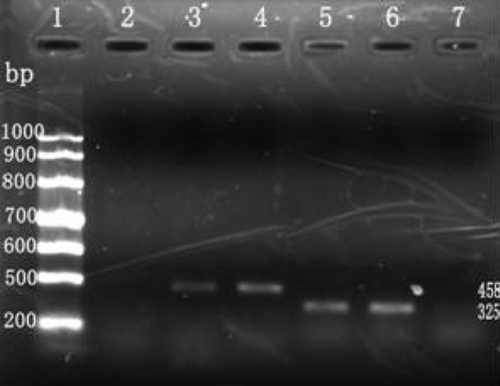 Figure 2.  Detection of collagen type II and aggrecan mRNA expression by RT-PCR. 1: RNA marker; 2: Col II expression of BMSCs without induction; 3: Col II expression of induced cells; 4: Col II expression of chontrocytes; 5: aggrecan expression of induced cells; 6: aggrecan expression of chontrocytes; 7: aggrecan expression of BMSCs without induction.