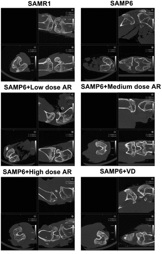 Figure 1. Detection of femur bone structure in mice by Micro-CT A-F showed in different treatment groups. A, SAMR1 group (normal control); B, SAMP6 group (negative control); C, SAMP6 + low dose AR group; D, SAMP6 + medium dose AR group; E, SAMP6 + high dose AR group; F, SAMP6 + VD (positive control)