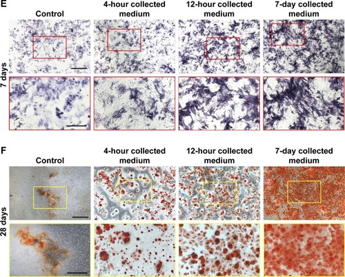 Figure 5 Bioactive release of irisin from i/SCS/P scaffold.Notes: (A) Release kinetics of irisin from i/SCS/P. Effect of different concentrations of irisin on BMSCs proliferation was detected by CCK-8 and analyzed in OD values (B) and fold changes (C) compared to the corresponding control group. At each scheduled time, BMSCs cultured in standard medium without irisin were taken as control. (D) ALP activity assay. The i/SCS/P scaffold was immersed in culture medium for 4 hours, 12 hours, and 7 days, respectively. The extracts at different times were used to culture BMSCs for 3 days and then treated with ALP activity assay. Culture medium with a same concentration of irisin, corresponding to what was calculated in the extract, was used as positive control. *P<0.05, compared with the corresponding positive control group. **P<0.05, compared with the 4 hours and 12 hours collected medium. (E) ALP staining at 7 days and (F) ARS staining at 28 days. BMSCs were cultured with the different extracts of i/SCS/P. BMSCs cultured with the extracts of SCS/P scaffolds were used as control. Lower magnification images (scale bar: 1 mm) are shown in the upper panel. The region of interest is selected by a red or yellow box and magnified with higher magnification (scale bar: 500 µm) in the lower panel.Abbreviations: CON, control; I, irisin; i/SCS/P, irisin-loaded silk/calcium silicate/sodium alginate/PVA; BMSCs, bone marrow stem cells; CCK-8, cell counting kit-8; ALP, alkaline phosphatase; ARS, alizarin red S; SCS/P, silk/calcium silicate/sodium alginate/PVA.