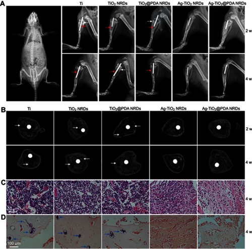 Figure 7 Implant infection model in vivo. (A) X-ray examination of the osteomyelitis model implanted with Ti rod 1 hr after surgery (left panel) and different kinds of rods at 2 weeks and 4 weeks (right panel), red arrows indicate osteolysis, white arrows indicate periosteal reaction; (B) cross-sectional images of micro-CT of different samples at 2 weeks and 4 weeks, white arrows indicate sequestrum; (C) H&E stain of different samples at 4 weeks (scale bars =50 μm); (D) gram stain of different samples at 4 weeks (scale bars =100 μm), blue arrows indicate MRSA colonies.