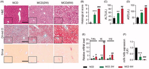 Figure 1. MiR-146 b expression was decreased in NAFLD. Mice were fed with NCD (n = 11) or MCD for 2 (n = 9) or 6 (n = 9) weeks. As shown in A, the MCD induced murine NAFLD model exhibited more severe inflammation, steatosis and fibrosis at week 6 than week 2, which were assessed by H&E, oil-red O and Sirius-red staining respectively, Scale bar, 100 µm. (B) Histological score in liver tissue from the three groups as described above. (C–D) Serum levels of ALT and AST by ELISA. (E) The expression of Tnfα, Il6 and Il1β in liver tissue either from WT mice that were fed a NCD or MCD by qPCR, Gene expression was normalized to β-actin. (F) qPCR analysis for miR-146b expression in liver tissues from the three groups as described above. Gene expression was normalized to the U6. Data represent as means ± SD; *p < .05, **p < .01, ***p < .001 versus NCD (2 weeks); #p < .05, ##p < .01, ###p < .001 versus MCD (6 weeks).