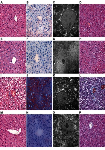 Figure 4 Histological evaluation of liver tissues with HE, Oil Red O staining, Mosson staining and transmission electron microscopy. Histological evaluation of liver tissues in each group stained with HE (×400), Oil Red O (×400) and Mosson staining (×400). Ultrastructural changes in liver tissues from each group (×10,000). ie, HE (A, E, I and M); Oil Red O (B, F, J and N); Mosson staining (D, H, L and P); transmission electron microscopy (C, G, K and O); N+S group (A, B, C and D); N+L group (E, F, G and H); O+S group (I, J, K and L); O+L group (M, N, O and P).