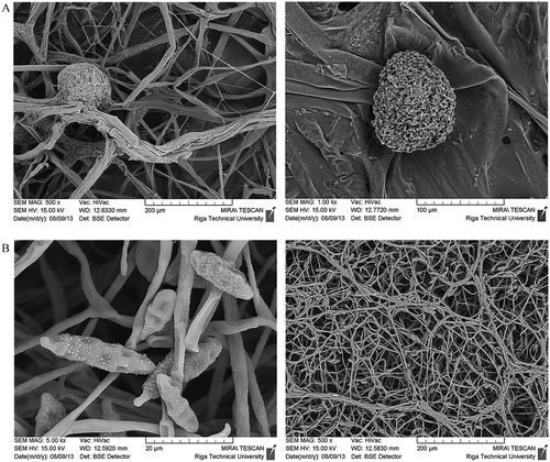 Figure 3. Microflora of apples Mucor circinelloides. (a), Alternaria alternata. (b), after storage.