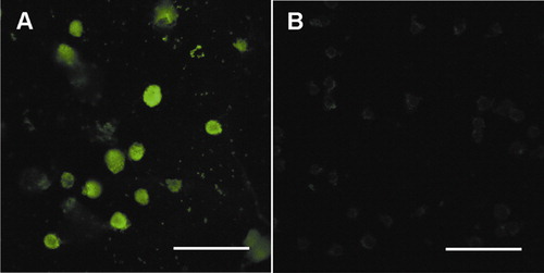 Figure 1. (A) Photomicrograph of Stat3 proteins expressed in HL-60 cells. (B) The control of secondary antibody only. Bar = 50 μm.