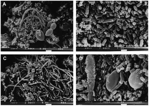 Figure 2. Scanning electron micrographs of Tibetan kefir grains. (A, C) The inside surface of Tibetan kefir grain. (B, D) The outside surface of Tibetan kefir grain (Zhou et al., Citation2009).