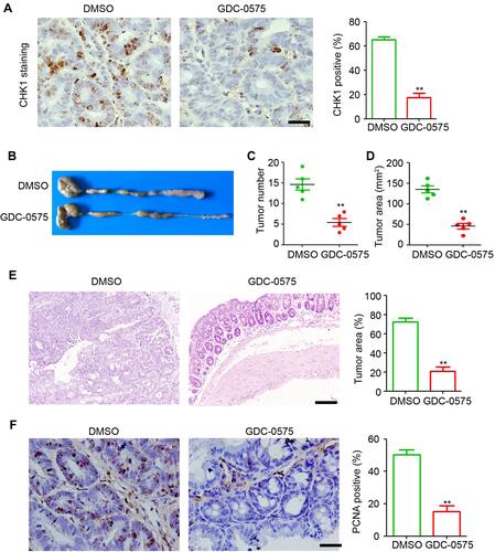 Figure 1 GDC-0575 impairs the development of colitis-associated cancer in mice. (A) IHC staining of CHK1 expression in colons of CAC mice treated with DMSO or GDC-0575. The percentage of CHK1 positive cells in each frame was analyzed. Scale bar = 100 μm. (B) Image of colons of CAC mice treated with DMSO or GDC-0575. (C) The tumor number in colons of CAC mice treated with DMSO or GDC-0575 (n=5, **p<0.01). (D) The tumor area in colons of CAC mice treated with DMSO or GDC-0575 (n=5, **p<0.01). (E) H&E staining of colons from colons from CAC mice treated with DMSO or GDC-0575. The tumor area in each frame was analyzed (n=4, **p<0.01). Scale bar = 200 μm. (F) IHC staining of PCNA expression in colons of CAC mice treated with DMSO or GDC-0575. The percentage of PCNA positive cells in each frame was analyzed. Scale bar = 100 μm, **p<0.01.