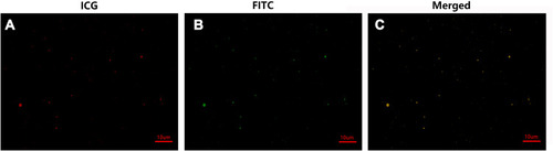 Figure 4 Verification of the coupling of PSMA-binding peptides to the surfaces of the PSMAP/ICG NBs When observed under a confocal laser scanning microscope, the NBs with encapsulated ICG in the lipid shell showed red fluorescence (A), and the FITC-labeled PSMA-binding peptides showed green fluorescence (B). The complete overlap of the two types of fluorescence resulted in yellow fluorescence (C).