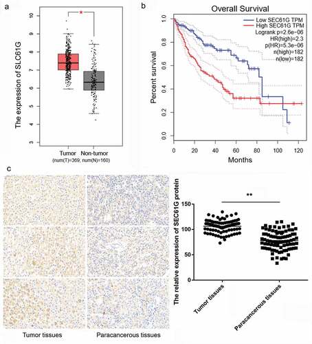 Figure 1. SEC61G is overexpressed in liver cancer and is associated with the survival time of patients. (a) The expression of SEC61G in liver cancer was significantly higher than that in paracancerous tissue by analyses from TCGA database. Number of tumor tissues was 369 and that of non-tumor tissues was 160. (b) SEC61G expression was negatively associated with survival time of patients. (c) IHC assay for tissue microarray paraffin blocks of HCC patients (N = 85) showed that SEC61G was also up-regulated in tumor tissues compared to paracancerous tissues. *** P < 0.01 compared with paracancerous tissues