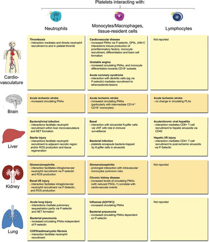Figure 2. Overview of PLA formation and their effects in (thrombo-) inflammatory pathologies of selected organs. Physical interactions of platelets with neutrophils, monocytes/macrophages, tissue-resident leukocytes or lymphocytes have been reported in a number of (thrombo-)inflammatory diseases of the circulatory system, brain, liver, kidney, and lung. Effects of platelet-leukocyte binding on cellular and/or molecular responses are summarised for individual leukocyte subtypes. COPD: chronic obstructive pulmonary disease, I/R: ischemia/reperfusion, JAM-C: Junctional adhesion molecule-C, NET: neutrophil extracellular trap, PMA: platelet-monocyte aggregate, PNA: platelet-neutrophil aggregate, PSGL-1: P-selectin glycoprotein ligand 1, ROS: reactive oxygen species, vWF: von Willebrand factor.