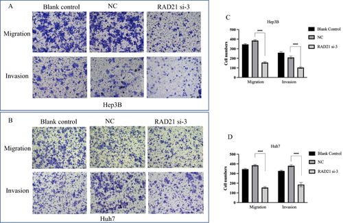 Figure 8 Effect of RAD21 knockdown on migration and invasion of liver cancer cells. Transwell migration and invasion assays detected decreased migration and invasion capabilities of Hep3B (A and B) and Huh7 (C and D) cells after RAD21 knockdown. Note: **** indicates p< 0.0001.