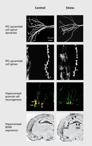 Figure 2. Influence of stress on the morphology and proliferation of neurons and neurotrophic factor expression. Exposure to immobilization stress decreases the number and length of pyramidal cell apical dendrites, and the number of spines in the prefrontal cortex (PFC). Stress also decreases the birth of new neurons and expression of brain derived neurotrophic factor (BDNF) in the adult hippocampus (HP). Images courtesy of Drs G. Aghajanian and R-J. Li.
