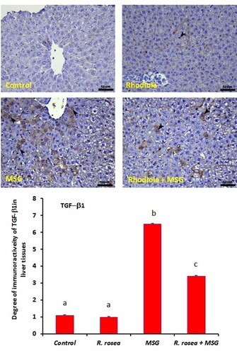 Figure 6. Liver sections of control group (Upper left photo) and R. rosea group (Upper right photo), with a very faint reaction for TGF-β1 within hepatocytes in the centrilobular area of the liver. Down left photo shows the liver of MSG-administered rats, exhibiting upregulation in TGF-β1 expression (arrowheads) inside hepatocytes. Down right photo is the liver section of MSG plus R. rosea-treated rats, with a decrease in TGF-β1 immunoreactivity (arrowheads) within most of the hepatocytes. Scale bar for all fields is 50 µm. The immunoreactivity percentage (%) of TGF-β1 is shown in E. All values are expressed as means + SE. Values with different letters are significant at *p < 0.05 compared to other groups.