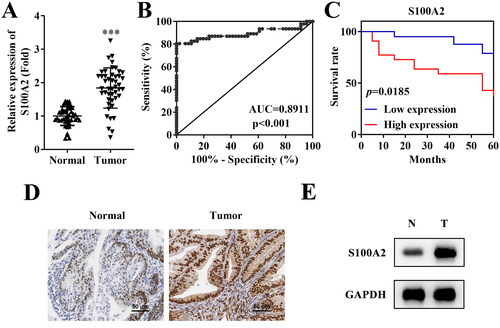 Figure 1. High expression of S100A2 is associated with poor prognosis of endometrial cancer. (A) PCR analysis of S100A2 mRNA expression in tissues of endometrial cancer and adjacent normal tissues, ***p < .001, n = 46. (B) The receiver operating characteristic (ROC) curve of S100A2 in endometrial cancer, AUC = 0.8911, p < .001. (C) Kaplan–Meier’s survival curve for endometrial cancer patients according to S100A2 expression in tumour lesions, p = .0185. The protein expression of S100A2 accessed by (D) immunohistochemistry method and (E) western blot, n = 3.