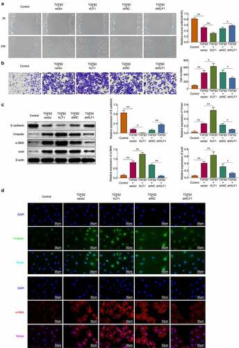 Figure 3. KLF1 promoted the migration and invasion of human lens epithelial cells by activating the EMT. (a) The migration of human lens epithelial cells detected by wound healing assay. (b) The invasion of human lens epithelial cells explored by transwell. (c) The expression of EMT related proteins determined by western blotting. (d) The expression of EMT associated proteins in human lens epithelial cells detected by immunofluorescence. * p < 0.05, ** p < 0.01, *** p < 0.001