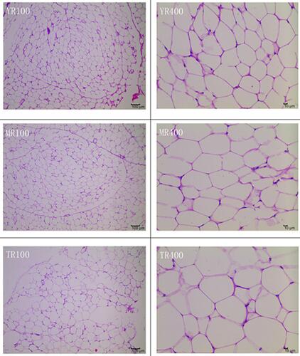 Figure 1 Morphological observation of visceral adipose tissue at different growth stages in rabbits.