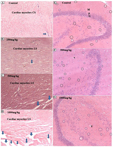 Figure 5 Photomicrographs of heart (A–D) and brain (E–G) sections (magnification: X100, H&E). (A–D) shows normal myocardial sections with clear cardiac fibers except areas of the heart that formed artificial spacing during cardiac puncture (arrows). CS: cross-section, LS: Longitudinal section. (E–G) Cerebellum with Granular (G), purkinje (P) and Molecular (M) cell layers. There is a homogenous pinkish stromal necrosis with an area of early phase of liquefactive necrosis and vacuolations (Oval circles). V: Blood vessels.