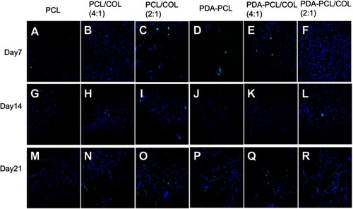 Figure 11 Runx-2 expression using immunofluorescent staining assay. (A, G, M) TSPCs cultured on PCL for day7, day14, day21. (B, H, N) TSPCs cultured on PCL/COL (4:1) for day7, day14, day21. (C, I, O) TSPCs cultured on PCL/COL (2:1) for day7, day14, day21. (D, J, P) TSPCs cultured on PDA-coated PCL for day7, day14, day21. (E, K, Q) TSPCs cultured on PDA-coated PCL/COL (4:1) for day7, day14, day21. (F, L, R) TSPCs cultured on PDA-coated PCL/COL (2:1) for day7, day14, day21, scale bars: 50 µm.Abbreviations: TSPCs, tendon stem/progenitor cells; PCL, polycaprolactone; COL, collagen; PDA, poly(dopamine).