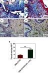 Figure 6 Evaluation of neovascularization at 4 weeks post-implantation. (A–B) Representative Masson’s trichrome staining images after implantation with DBB granules and covering with PTFE membranes (A) or BTO/P(VDF-TrFE) nanocomposite membranes (B). (C–D) Immunohistological staining images for detection of α-SMA expression after implantation with DBB granules and covering with PTFE membranes (C) or BTO/P(VDF-TrFE) nanocomposite membranes (D). (E) Quantitative analysis of the number of nascent blood vessels after 4 weeks post-implantation (**p<0.01). Black arrowheads denote the nascent blood vessels. Scale bar =50 μm.Abbreviations: DBB, deproteinized bovine bone; NB, nascent bone; PTFE, polytetrafluoroethylene; BTO, BaTiO3; P(VDF-TrFE), poly(vinylidene fluoridetrifluoroethylene); α-SMA, alpha smooth muscle actin; HPF, high power fields.