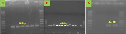 Figure 2 Representative agarose gel electrophoresis of DNA-amplified product generated by targeting specific regions of ORF30 EHV-1 (466 bp) (A) on 1.5% agarose gel with a DNA Molecular Weight Marker (MWM) of 200 bp, and EHV-2 gpB gene (444 bp) (B) and EHV-5 gpB gene (293 bp) (C) on 1.5% agarose gel with a DNA Molecular Weight Marker of 100 bp.