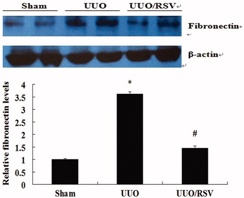 Figure 5. Effect of RSV on the protein level of fibronectin in the kidney samples of UUO mice. The data are expressed as the relative difference after normalization to the expression of β-actin. All values are expressed as mean ± SEM, *p < 0.01 versus the sham group; #p < 0.01, UUO versus the UUO/RSV group.
