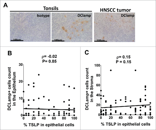 Figure 4. Mature DCLAMP+ DC infiltrate HNSCC tumors whatever the tumor-TSLP expression level Frozen section of (A) Tonsils and HNSCC tumor by means of immunohistology for DCLAMP (brown staining). DCLAMP+-cells were counted both (B) in the epithelium and (C) in the stroma of tumor tissues and compared with corresponding percentage of TSLP expression. Each symbol represents a different sample. Pearson correlation was calculated. Linear regression was added (black lines).