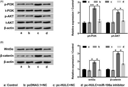 Figure 7. HULC overexpression boosted PI3K/AKT and Wnt/β-catenin pathways activities through raising miR-106a expression. TPC-1 cells were underwent different transfection, (A and B) the p-PI3K, t-PI3K, p-AKT, t-AKT, Wnt3α and β-catenin expressions in TPC-1 cells were tested. *p < .05; **p < .01.