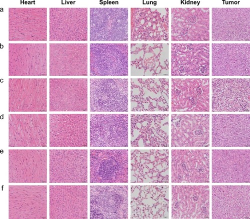 Figure 3 Histopathological examination of organs and tumor tissues in K562/A02 xenograft model after the treatment (hematoxylin–eosin staining, ×200).Notes: (a) Control, (b) DNR, (c) DNR and Tet, (d) DNR-NPs, (e) DNR-Tet-NPs, (f) DNR-Tet-Tf-NPs.Abbreviations: DNR, daunorubicin; Tet, tetrandrine; NPs, nanoparticles; Tf, transferrin.