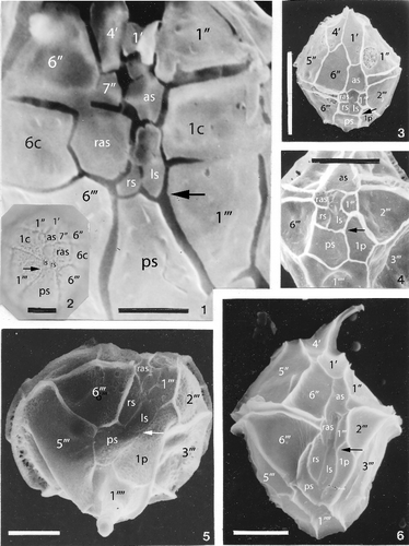 Plate 9. Comparison of midventral tabulation in some fossil representatives of the Order Gonyaulacales. Figures 1 and 2 are members of the ‘microdinoid’ group discussed in this paper, and are members of the Family Cladopyxiaceae (Suborder Cladopyxiineae) which have the partiform hypocystal configuration. Figures 3, 4 and 6 are members of the Family Gonyaulacaceae (Suborder Gonyaulacineae) which have the sexiform configuration. Figure 5 is a member of the Family Goniodomaceae (Suborder Goniodomineae) which has the quinqueform configuration. The microdinioid pattern is nearly identical topologically to the sexiform and quinqueform patterns, except for the relative position of the upper margin of the posterior sulcal plate with respect to the plates bordering the left side of the sulcus. In the partiform microdinioids, the contact of ps with two sulcals (probably ls and rs) abuts the first postcingular plate (the latitudinal position of this line of contact is indicated by an arrow in each photomicrograph), and ps thus contacts 1‴. In contrast, for most other gonyaulacaleans for which sulcal tabulation is well developed, this line of contact abuts the posterior intercalary plate, preventing contact between ps and 1‴. Note also that in the sexiform and partiform configurations, the antapical plate (1″″) contacts six plates including 6‴ (best seen in figures 4 and 6), while in the quinqueform configuration (figure 5) the antapical contacts only five plates, with no contact with 6‴. 1. Histiocysta sp. B from the Maastrichtian Navesink Formation, Atlantic Highlands, New Jersey; ventral orientation (scanning electron photomicrograph provided by F.E. May); scale bar = 5 µm. 2. Histiocysta sp. A from the Ypresian (Early Eocene) Nanjemoy Formation, Popes Creek, Maryland; dorsal view of ventral surface; Nomarski interference contrast (same specimen as in Plate 5, figures 1–3; scale bar = 10 µm. 3, 4. Leptodinium mirabile Klement 1960 emend. Sarjeant 1984; scanning electron photomicrographs of two specimens from Amber Bay, Alaska, Late Jurassic. Scale bars: figure 3 = 50 µm; figure 4 = 25 µm. 5. Biconidinium longissimum Islam 1983 from the Ypresian (Early Eocene) Nanjemoy Formation, Popes Creek, Maryland; ventral orientation highlighting hypocystal tabulation. Scanning electron photomicrograph; scale bar = 10 µm. 6. Cribroperidinium sp. from the Maastrichtian of the Netherlands, Albert Canal; ventral orientation. Scanning electron photomicrograph; scale bar = 25 µm.