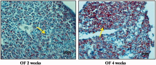 Figure 7. Histology images of Oil Red O staining and haematoxylin staining of overfeeding groups. Scale bar: 20 µm. Arrows indicate accumulation of fat vacuoles in zebrafish overfed with artemia over a period of 2 weeks and 4 weeks. 4 weeks overfeeding group showed higher accumulation as compared to 2 weeks overfeeding group.