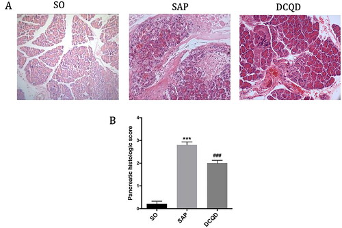 Figure 2. Impact of DCQD on STC-induced pancreatic injury. (A) Images of H&E staining, 200 × magnifications of pancreas tissues of each experimental group. (B) Pathological score of pancreas tissues of each experimental group. ***p < 0.001, compared with the SO group; ###p < 0.001, compared with the SAP group. n = 10–14.