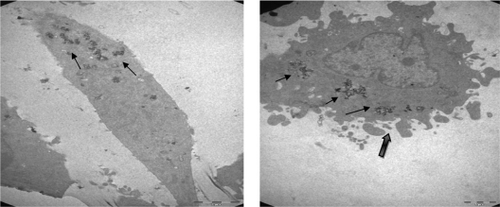 Figure 7 Transmission electron micrographs of 5RP7 cells; E) (8200×) (treated with 4.5 μg/mL folic acid-modified magnetic nanoparticles for 24 hours. F) (11,500×) treated with 4.5 μg/mL folic acid-modified magnetic nanoparticles for 48 hours leading to apoptotic blebbing.