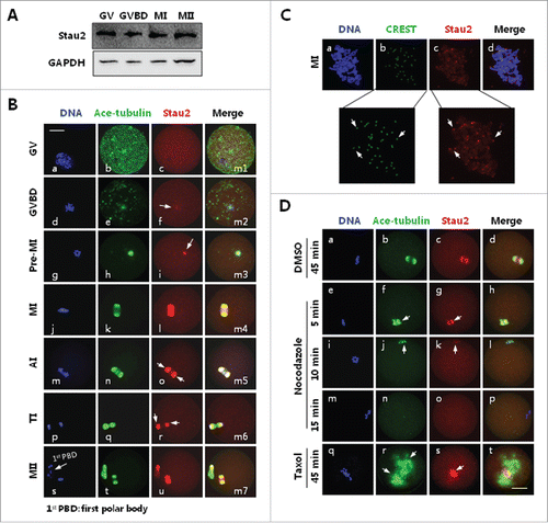 Figure 1. Expression and subcellular localization Stau2 in mouse oocyte during meiosis. Mouse oocytes were cultured in vitro in MEM medium with 10 % FBS for 0, 2, 4, 8, 12,17 h, corresponding to meiotic stages of germinal vesicle (GV), germinal vesicle breakdown (GVBD), pro-metaphase I (pro-MI), metaphase I (MI), anaphase I/telophase I (AI/TI) and metaphase II (MII), respectively, and collected for analysis with western blot and immunofluorescence. A. Western blot analysis revealed stable expression of Stau2 in mouse oocytes during meiotic division. Protein samples of 50 oocytes, at GV, GVBD, MI and MII stages, respectively, were prepared and segregated on 10% SDS-PAGE separation gel and immunoblotted with Stau2, GAPGH was placed as a loading control. B. Immunofluorescence analysis detected dynamic subcellular distribution in oocytes during meiosis. No special accumulation of Stau2 was detected at GV stage (c). Upon GVBD, Stau2 was aggregated as filaments and colocalized with microtubules around condensing chromosomes (g: arrow). During the meiotic progression from pro-MI to MI, Stau2 was gradually organized into bipolar structure and precisely overlapped with the meiotic spindle assembled from microtubules (j, k, n, o). During AI to TI transition, Stau2 remained colocalized with microtubules but excluded in the midbody structure (r, s: arrows). As oocytes developed to MII stage, Stau2 was assembled into “spindle-like” organization again and overlapped with the MII spindle, Stau2 was also colocalized with microtubules in first polar body (u-x). Stau2 was visualized in red, microtubule was labeled with antibody against acetylated-tubulin (ace-tubulin) and visualized in green, and DNA was visualized in blue. Scale bar = 20 μm. C. Immunostaining analysis revealed Stau2 accumulation across chromosomes, with particular concentration on the centromere areas (arrows in boxes). Stau2 was visualized in red, centromere was probed with CREST auto serum and visualized in green, and DNA was visualized in blue. Scale bar = 20 μm. D. Stau2 distribution was associated with microtubule integrity and stability in oocytes. MI oocytes were treated with 20 μg/ml nocodazole for 5, 10 and 15 min or 10 μM taxol for 45 min, then fixed for immunostaining with acetylated-tubulin (ace-tubulin) and Stau2. During incubation with nocodazole, Stau2 was gradually disassembled (f, g, n) together with microtubules (g, k, o). After taxol treatment, microtubules were stabilized in spindle and cytoplasmic microtubule organizing centers (MTOCs) (r: arrows), meanwhile Stau2 was congressed in the vicinity around chromosome alignment and absent on microtubules (s, t). Microtubules were visualized in green, Stau2 was visualized in red and DNA was labeled in blue. Scale bar = 20 μm.