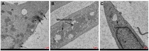 Figure 10 Electron microscopy images showing the ultrastructure of HSFs incubated for 3–4 h in 5 µg/mL cuprous oxide nanoparticles (CONPs). Several CONPs crossed the cell membrane (A) and entered the mitochondria (B), and lysosome (C).