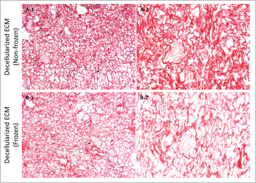 Figure 9. Sirius red stain imaging representative of general collagen for frozen/thawed and non-frozen decellularized kidney samples at 10X (A-1 & B-1) and 20X (A-2 & B-2) magnifications. General collagen seemed to be partially damaged through freezing/thawing since stain color was lighter for frozen/thawed samples; however, the difference was not as stark as for native kidneys after freezing/thawing. Also, the porosity was greater in frozen/thawed decellularized kidney samples, which is again indicative of fibril damage and diminished integrity (arrows show renal corpuscles).