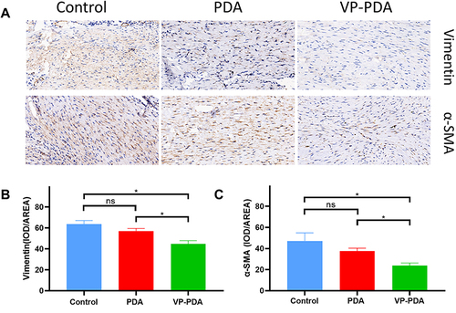 Figure 6 Verapamil-loaded polydopamine nanoparticles reduced the expression of vimentin and α-smooth muscle actin (α-SMA) in the repaired tendons at four weeks after surgery. (A) The expression of vimentin and α-SMA was detected using immunohistochemistry. (B and C) The expression scores in vimentin and α-SMA. PDA NPs, polydopamine nanoparticles. VP-PDA NPs, verapamil-loaded polydopamine nanoparticles. The bars represent mean ± SEM (n = 6 per group) *p<0.05; ns, not significant.