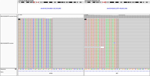 Figure 3 The integrative genomics viewer (IGV) screenshots revealed the harboring of KIF5B-RET fusion.