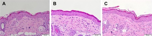 Figure 6 Histological examination of nude mouse skin stained with H&E after 7-day treatment of topically applied control solution and DA liposomes.Note: (A) Non-treated skin, (B) control solution, and (C) DA liposomes.Abbreviations: H&E, hematoxylin and eosin; DA, deoxycholic acid.