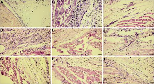 Figure 4 The photomicrographs of paw tissue after hematoxylin-eosin staining demonstrated that compounds 10b and 13b diminished histological alterations induced by carrageenan injection. Indomethacin was used as a reference drug. Experimental groups: control group (A); carrageenan group (B); group receiving 10 mg/kg indomethacin (C); group receiving 5 mg/kg compound 10b (D); group receiving 10 mg/kg compound 10b (E); group receiving 20 mg/kg compound 10b (F); group receiving 5 mg/kg compound 13b (G); group receiving 10 mg/kg compound 13b (H); group receiving 20 mg/kg compound 13b (I); magnification 200×.