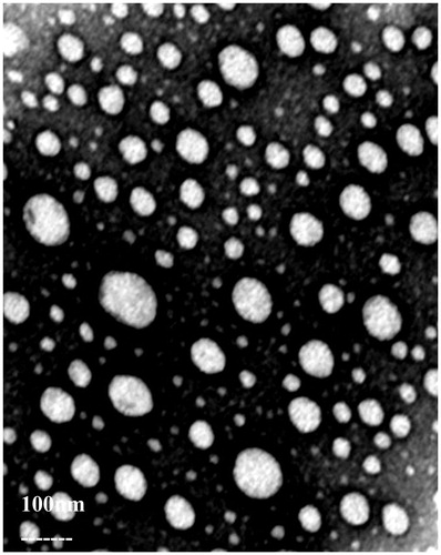 Figure 2. Transmission electron microscope photograph of ACM-SLNs. × 3000.