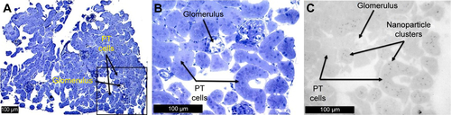 Figure S2 Thick kidney section of splenectomized mouse injected with (A) TEG particles, section stained with toluidine blue, 100×; (B) TEG particles, section stained with toluidine blue, 400×; (C) TEG particles, 400×.Abbreviations: TEG, tetraethylene glycol; PT, proximal tubule.