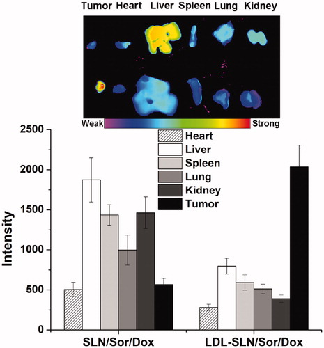 Figure 5. Quantitative ex vivo mean fluorescence intensity of dissected major organs and tumor at 24 h post injection of DiR labeled SLN/Sor/Dox (upper) and LDL/SLN/Sor/Dox (lower). Data were expressed as mean ± S.D. (n = 3).