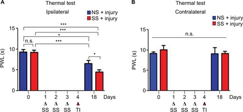 Figure 4 SS exacerbates thermal allodynia in thermally injured rats.